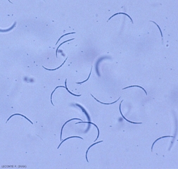 Optical microscopic appearance of the conids or stylospores of <i> <b> Eutypa lata </b> </i>.  They are hyaline, tapering and arching.  (eutypiosis)