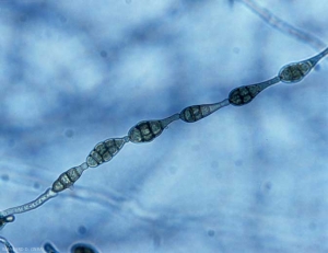 <b> <i> Alternaria alternata </i> </b> spores are produced in long chains at the end of conidiophores (longicatenatae).  The conidia are brownish, multicellular and have a relatively short appendage (black mold rot).