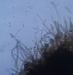 The short, dark, branched conidiophores carry the non-septate to bicloisate conidia.  <i> <b> Cladosporium cucumerinum </b> </i> 