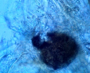 Appearance of a globular and black pycnidia of <i> <b> Macrophomina phaseolina </b> </i>;  its diameter can fluctuate between 100 and 250 µm.