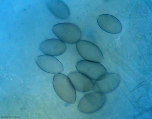 Several more or less melanized sporangia are visible on this blade observed under a light microscope.  <i> <b> Pseudoperonospora cubensis </b> </i> (downy mildew)