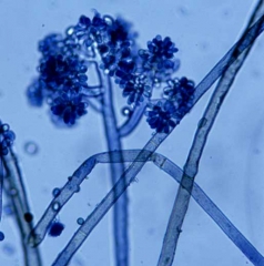 The conidiophores of <b> <i> Botrytis cinerea </i> </b> are bushy and produce hyaline and ovoid spores.  <b> Gray mold </b>