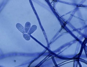 This conidiophore of <i> <b> Trichothecium roseum </b> </i> bears a few hyaline, elongated to pear-shaped conidia, some of which are bicellular.  (pink rot)