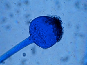 Columella of <i> <b> Rhizopus stolonifer </b> </i> present at the end of a sporocystophore.  Dark spores are still in place locally.