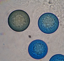 Several asci containing a single spherical ascospore.  <i> <b> Monosporascus </i> sp. </b>