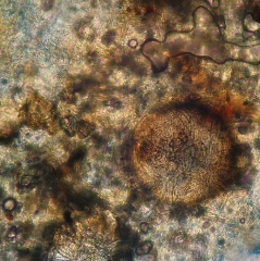 Spherical and brown perithecium in place in the cortex of a root.  <i> <b> Monosporascus </i> sp. </b>