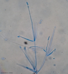 Close-up on some conidiophores of <b> <i> Verticillium dahliae </i> </b> at the end of which ellipsoid conidia of this fungus are still present (verticillium wilt, <i> Verticillium </i> wilt ).