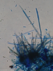 Detail of a young conidium forming at the tip of a melanized conidiophore.  Note the presence of a few transverse septa at the base of the spore.  <i>Cercospora longissima</i> (cercospora leaf spot)