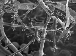 Detail of the sterigmas present at the ends of the arbuscular sporangiophores and on which the sporangia are formed. (view under a scanning microscope) <i><b> Plasmopara viticola </i></b> (Nathalie PICHON)