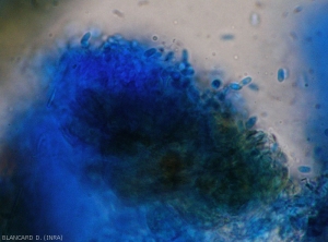 Concentration of conidiophores at the end of which they begin to form conidia (mature acervule). <i> <b> Elsinoë ampelina </b> </i>