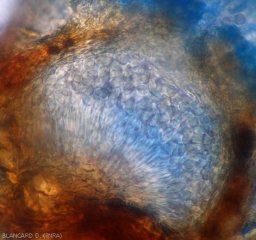 Sectional view of a <i><b>Pilidiella diplodiella</i></b> pycnidia.  We can clearly distinguish parallel conidiophores and young conidia (white rot).
