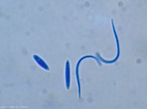 The pycnidia (a) of <b> <i> Phomopsis viticola </i> </b> produce two kinds of conidia: alpha ovoid to fusoid spores and beta spores, filiform and arched.