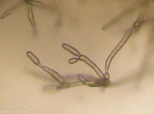 Appearance with a binocular magnifying glass of young conidiophores on which conidia are starting to form <b> <i> Cladosporium </i> sp. </b> (<i> Cladosporium </i> rot)