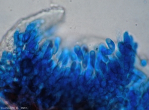 Formation of numerous conidia inside an acervule observed in section under a light microscope.  .  <i> <b> Colletotrichum </i> sp </b>.  (ripe rot)