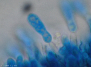 Detail of the formation of hyaline and guttulate conidia at the end of a conidiophore present in an acervule of <i> <b> Colletotrichum </i> sp </b>.  (ripe rot)