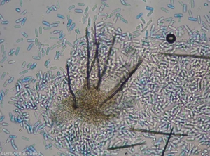 This acervule, endowed with several brown to blackish septate bristles, and surrounded by numerous hyaline conidia.  <i> <b> Colletotrichum </i> sp </b>.  (ripe rot)