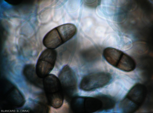 The conidia of <i> Lasiodiplodia theobromae </i> are initially hyaline and not septate, and turn dark brown, featuring a septum and irregular longitudinal striations.  (anamorph of <i> Botryosphaeria rhodina </i>)