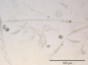 <b><i> Fusarium oxysporum </i> f.  sp.  <i> melongenae </i></b> forms macro- and microconidia, as well as chlamydospores that ensure its dissemination and preservation. 