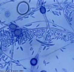 <b> <i> Fusarium oxysporum </i> f.  sp.  <i> lycopersici </i> </b> produces unicellular microconidia and crescent-shaped macroconidia with a maximum of 3 to 4 septa.  It also forms thick-walled, intercellular or terminal chlamydospores and isolated or in chains.  <b> Fusarium wilt (<i> Fusarium </i> wilt) </b>