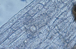 Round, thick-walled oospores are present on or in root tissues;  they frequently materialize the parasitism of <b> <i> Pythium </i> spp. </b> ("damping-off").