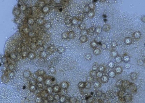 <b> <i> Bremia lactucae </i> </b> (downy mildew) is a heterothallic fungus;  two sexual types exist (B1 and B2).  Their meeting leads to the formation of spherical oogons with a thick wall.  These structures are rarely found in nature on plant debris.