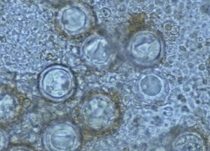 In damaged tissue, brown oospores are sometimes observed 27–30 µm in diameter.  They ensure the sexual reproduction of this heterothallic fungus.  <i> <b> Bremia lactucae </b> </i> (downy mildew)