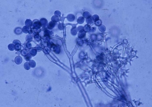 <b> <i> Bremia lactucae </i> </b> (downy mildew) produces shrubby sporangiophores with mainly dichotomous branching, carrying at the end of sterigmas rather circular sporangia whose diameter ranges from 12 to 30 µm in diameter.