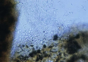Discrete fruiting bodies of the fungus, the acervuli, form on the spots.  They are made up of very many conidiophores grouped together;  these generate hyaline, bicellular, cylindrical and slightly curved conidia.  <b> <i> Microdochium panattonianum </i> </b> (anthracnose, "shot-hole")