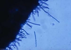 On necrotic tissues, we can easily observe tapering conidiophores, grouped in clusters, carrying at their end filiform and multicellular conidia.  <b> <i> Cercospora longissima </i> </b> (Sigatoka, "<i> cercospora </i> leaf spot")