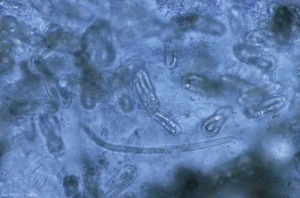 Around the roots, we can distinguish mature eggs containing a young larva with a clearly visible stylet.  <b> <i> Meloidogyne </i> sp. </b> ("root-knot nematodes")