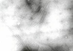 Flexuous viral particles 15nm in diameter and about 750nm long (potyvirus type).  <b> Lettuce mosaic virus </b> (<i> Lettuce mosaic virus </i>, LMV)