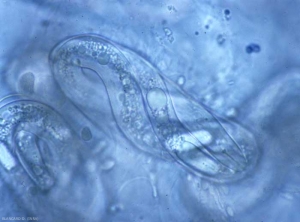 Egg of <b> <i> Meloidogyne sp. </i> </b> ("root-knot nematodes") containing a young larva with a clearly visible stylet.