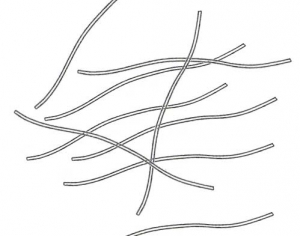 Flexuous viral particles 15nm in diameter and about 750nm long (potyvirus type).  <b> Chicory necrotic mosaic virus </b> (<i> Endive necrotic mosaic virus </i>, ENMV)