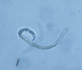 <i> Pratylenchus </i> are fairly short nematodes with a prominent buccal stylet.  <b> <i> Pratylenchus penetrans </i> </b> ("lesion nematodes")