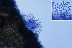 Pycniospores are released at maturity from the pycnidia.  These conidia are colorless, ovoid and measure approximately 5 x 7 µm.  <b> <i> Guignardia bidwellii </i> </b> (black rot)
