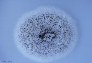 On the hyaline and white mycelium of <i> <b> Aspergillus niger </b> </i> we can clearly see the black sporulation of this ascomycete darkening the colony.