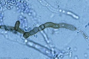 This <b> <i> Aureobasidium pullulans </i> </b> hyphae is gradually melanizing to eventually give rise to arthroconidia.