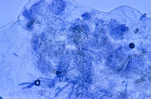 When penetrated under the skin of the berry, <b> <i> Botrytis cinerea </i> </b> forms aggregates of mycelium.