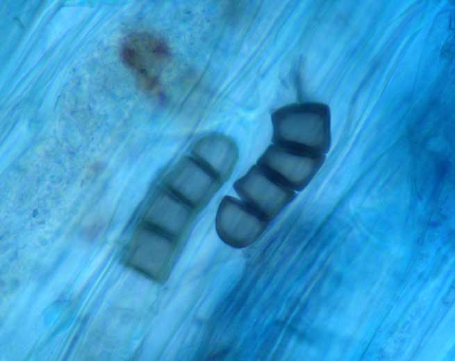 Aspecto al microscopio fotónico de clamidosporas en raíces de melón de <i> <b> Thielaviopsis basicola </b> </ i> (podredumbre negra)