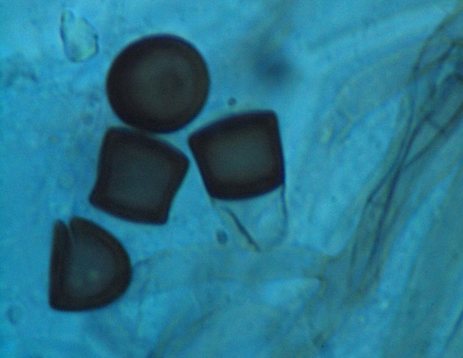 Aparición de algunas clamidosporas desarticuladas de color marrón oscuro de <i> <b> Thielaviopsis basicola </b> </i>.  (podredumbre negra)