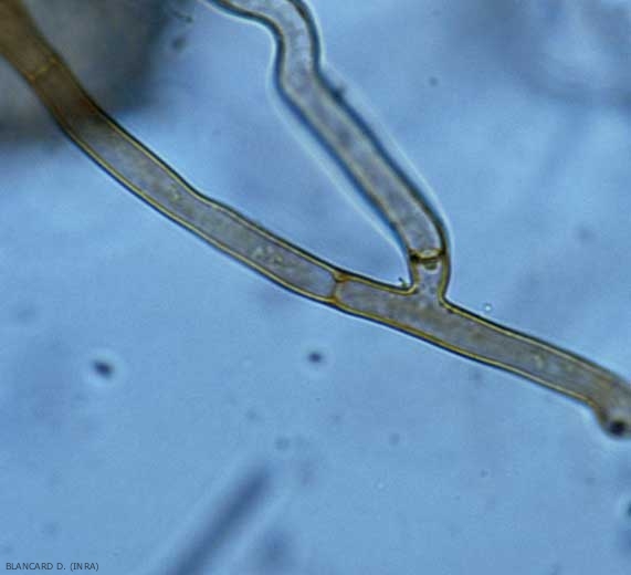 El micelio de <b> <i> Thanatephorus cucumeris </i> </b> (<i> Rhizoctonia solani </i>) se caracteriza por su aspecto robusto, un ancho entre 5 y 15 µm y una coloración marrón oscura. .  También hay una ligera constricción en las ramificaciones laterales, así como la presencia de tabiques.