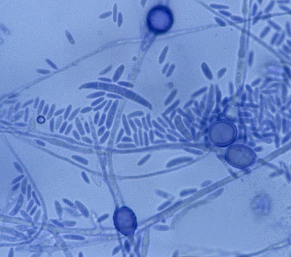 <b> <i> Fusarium oxysporum </i> f.  sp.  <i> melonis </i> </b> forma macro y microconidios, así como clamidosporas que aseguran su difusión y conservación.  (fusarium)