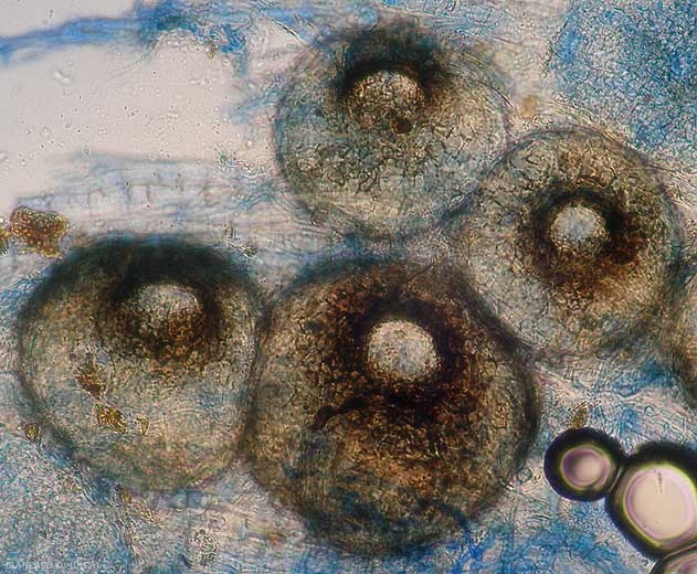 Cuerpos fructíferos de <i> <b> Didymella bryoniae </b> </i> observados al microscopio óptico.