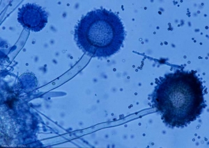 Conidiófros biseriale de<b><i>Aspergillus</i> sp.</b> 