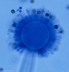 Es en esta vesícula, típica del género <i> Aspergillus </i>, donde se ubican los fialidos, que cubren toda la superficie (radial) <b> <i> Aspergillus </i> sp. 