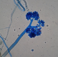 Conidióforo ramificado joven de <i> <b> Botrytis cinerea </b> </i> observado al microscopio óptico.