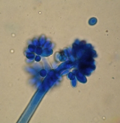 Aspecto de racimos de conidios en la punta de un conidióforo de <i> <b> Botrytis cinerea </b> </i>
