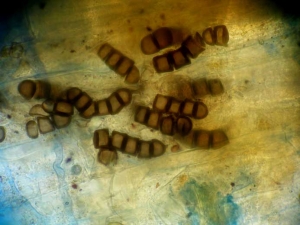 <b> <i> Thielaviopsis basicola </i> </b> (ex <i> Chalara elegans </i>, pudrición de la raíz negra) sobre berenjena.