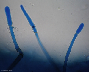 Se están formando conidios jóvenes en la punta de conidióforos erectos de<b><i> Corynespora cassiicola</i></b>