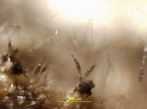 Los conidióforos y conidios de <b> <i> Alternaria tomatophila </i> </b> se pueden observar con una lupa binocular en los tejidos lesionados. Las esporas de este hongo, multicelulares y alargadas, son solitarias y provistas de una extensión hialina filiforme. <b> Alternaria (tizón temprano) </b> (Bruce WATT - Universidad de Maine)